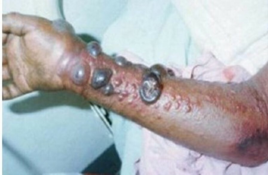 Crimee congo2
